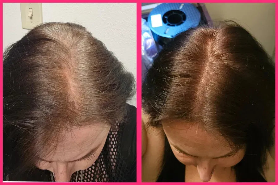 ColorNature - Shampoo Cubra Canas 3 in 1 + Tratamiento de Regalo