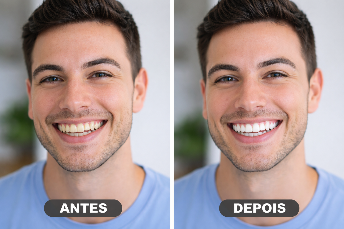 🦷 BLANCO TOTAL - tira blanqueadora